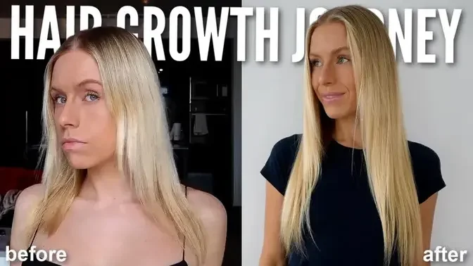 How I STOPPED MY HAIR LOSS! #1 Thing That Re-Grew My Hair