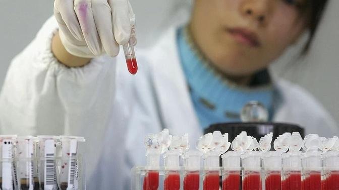 Dịch AIDS ở Trung Quốc đáng sợ hơn những gì được công bố