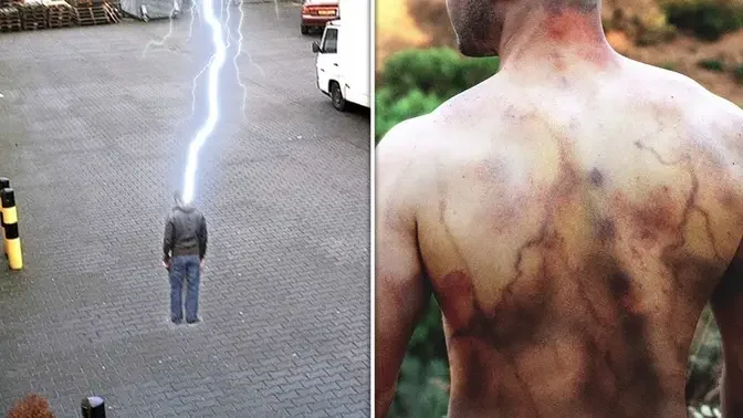 5 People Who Were Struck By Lightning