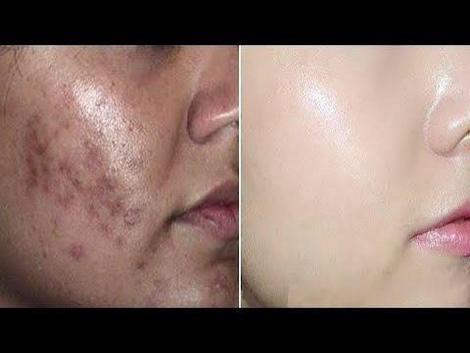 Apply This All Over Your Face Before Sleeping And Your Skin Will