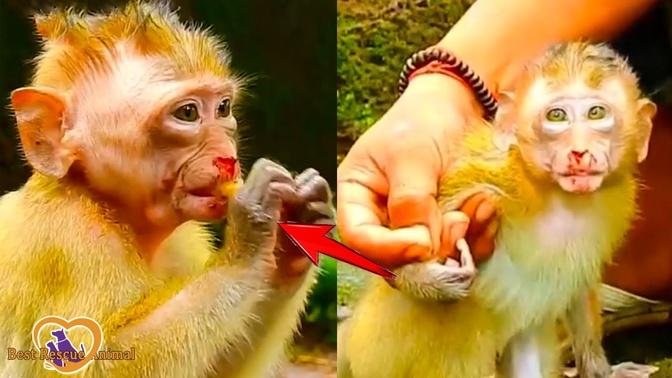 Breaking Heart Seeing Baby Monkey Hurt, He Fell From High Tree And Bloody From Nose