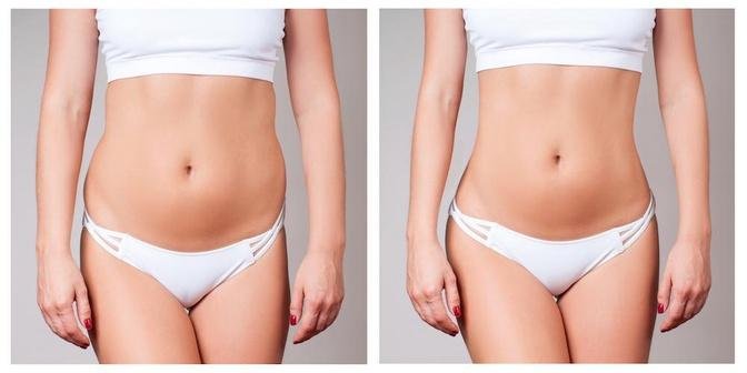 From Flab to Fab: Transform Your Body with TruSculpting