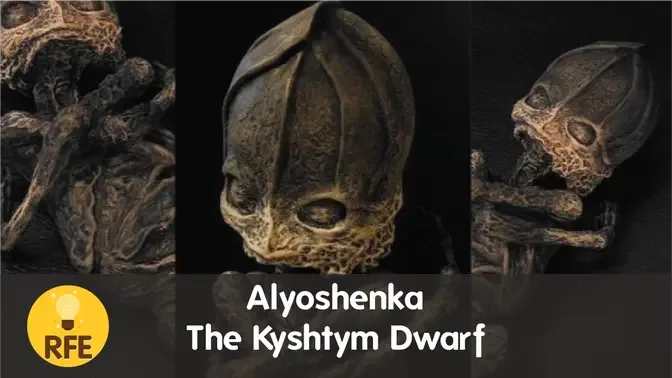 Alyoshenka - The Kyshtym Dwarf