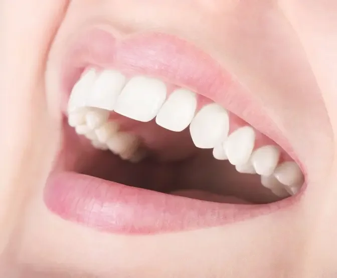 Improving Self-Esteem: The Psychological Impact of Dental Veneers