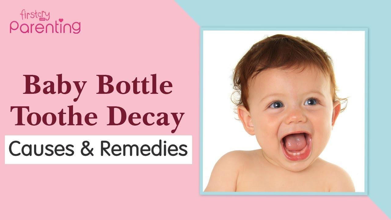 Baby Bottle Tooth Decay : Causes and Prevention