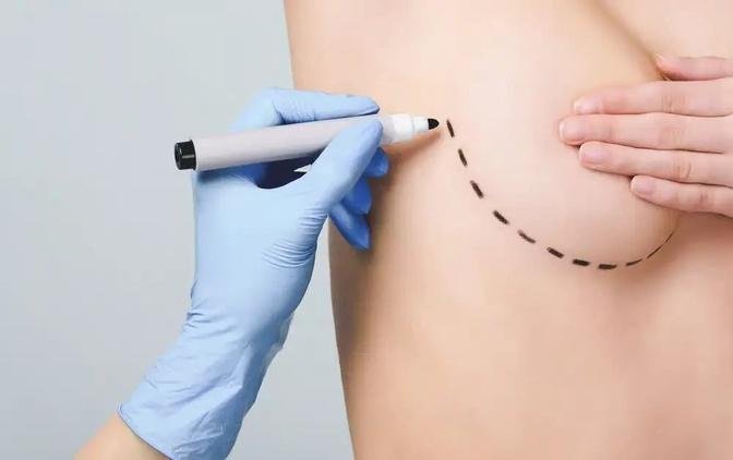 A Comprehensive Guide to Breast Augmentation Surgery