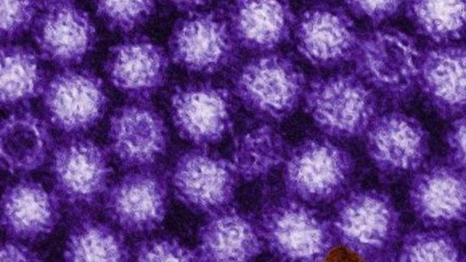 Norovirus: What You Need to Know