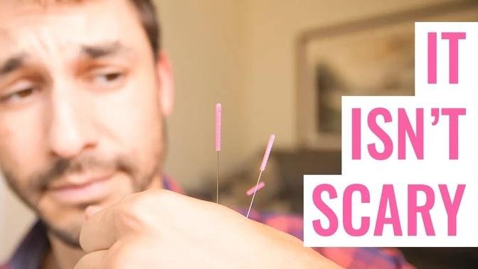 Acupuncture: Why You Shouldn't Be Afraid Of Getting Poked | Videos | Dr ...