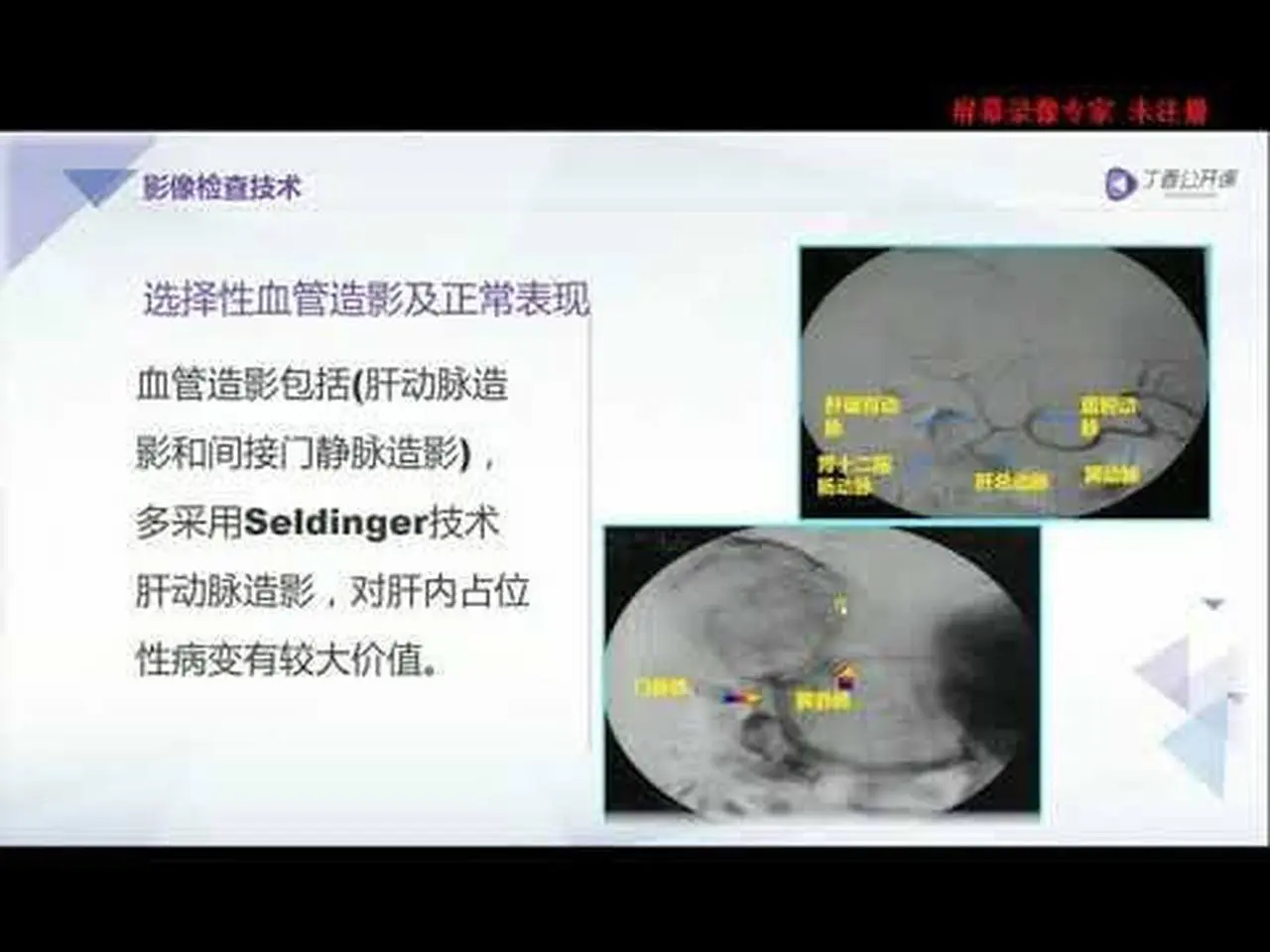 丁香园公开课|腹部CT| 1  肝脏的检查技术及正常CT解剖