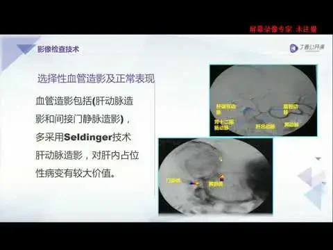 丁香园公开课|腹部CT| 1  肝脏的检查技术及正常CT解剖