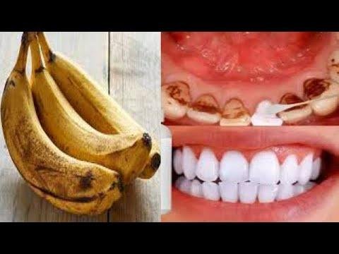 fastest way to whiten teeth at home get white teeth in 3minute
