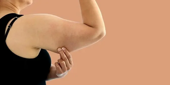 Arms of Elegance: Decoding the Pros and Cons of Arm Lift Surgery in Dubai