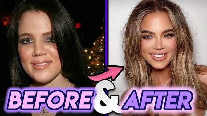 Khloe Kardashian | Before & After UPDATED | Shocking 2020 Transformation