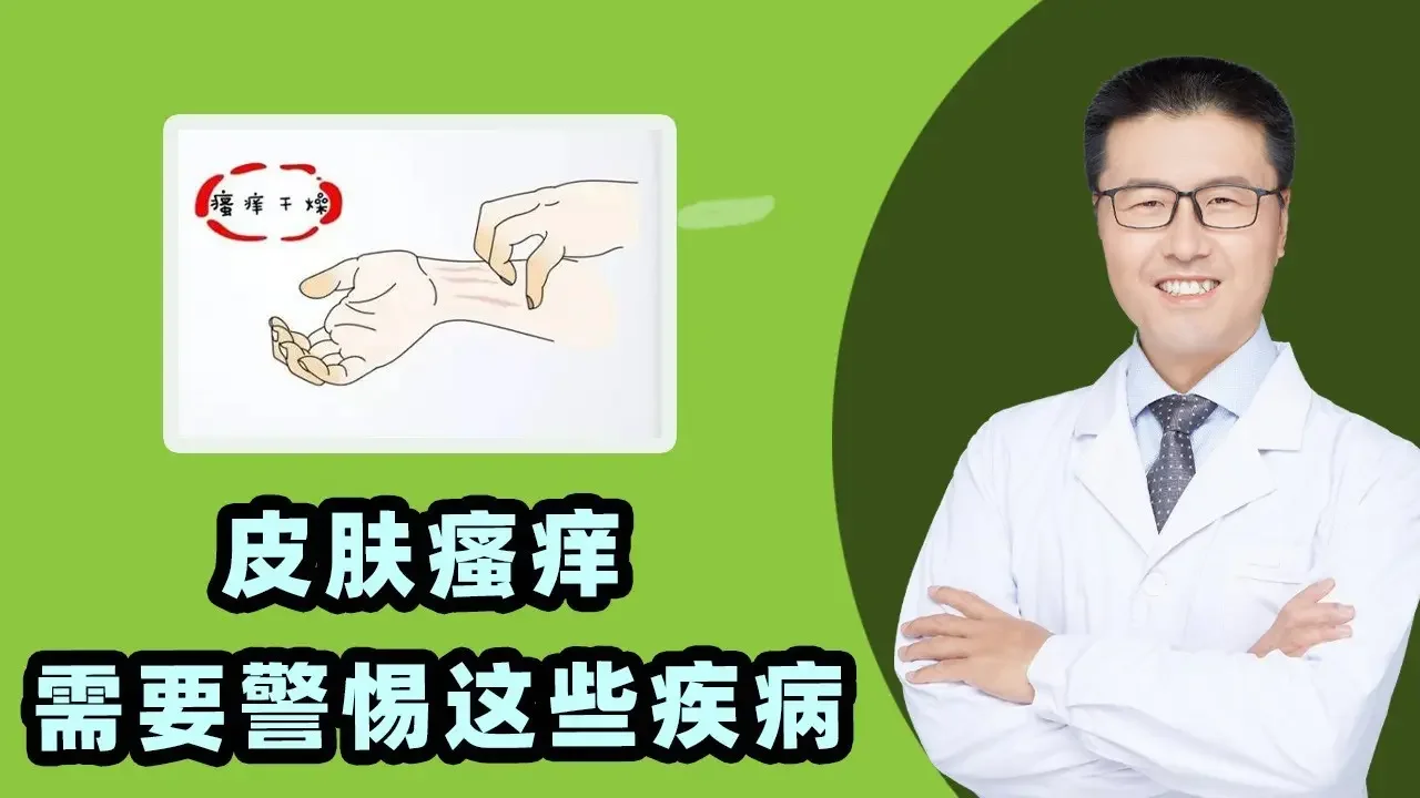 皮肤瘙痒需要警惕这些疾病！｜【老安谈健康】