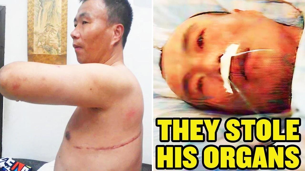 This Man Survived the CCP’s Organ Harvesting