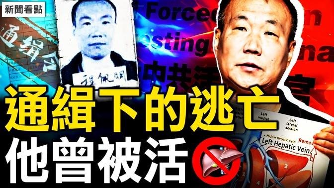 習近平犯3重罪？國際法庭將審判；20年前的病歷，35.5釐米的切口【新聞看點 李沐陽7.4】