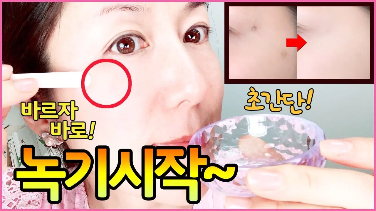 바르자마자😃🤚🏻녹기 시작!! 식소다+오일 한방울 바르기만 하면 피지, 잡티 녹음!